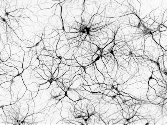 Las neuronas conforman un sistema emergente, reciben estímulos y conducen impulsos nerviosos; una analogía del funcionamiento de un súper-organismo. Fuente: medium.com